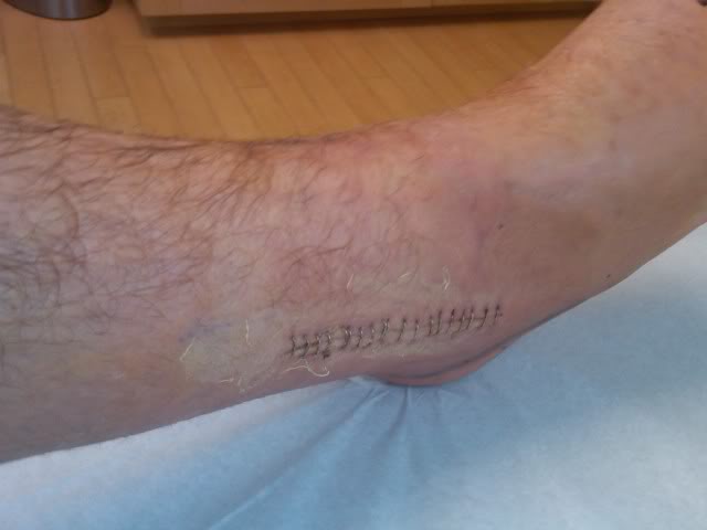 Name:  ankle5.jpg
Views: 52
Size:  20.7 KB